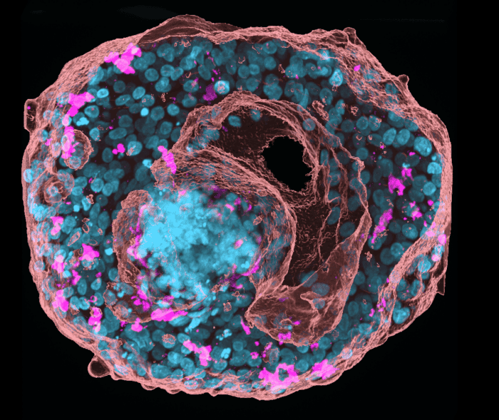 'Through cancer’s core' by E. Ma, ​2022 image competition winner.